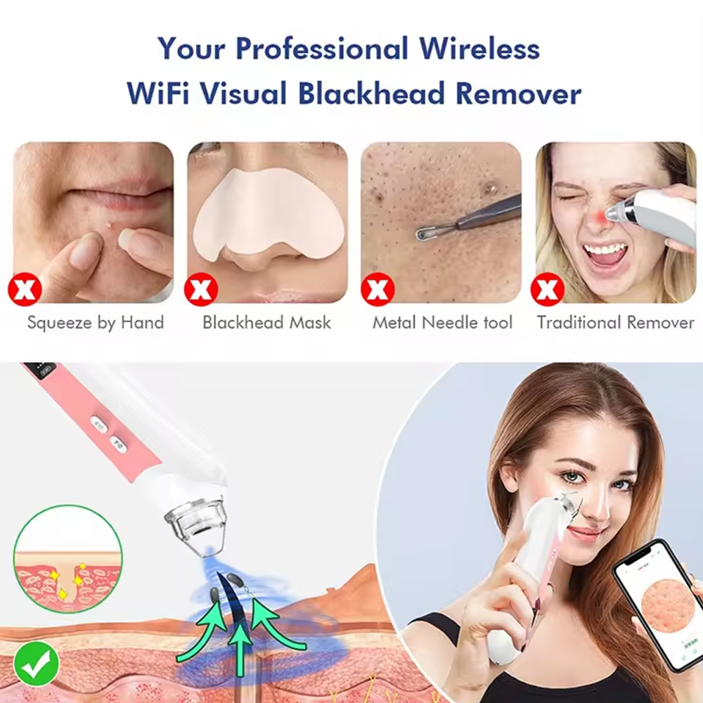 6 Heads Pore Cleaner Blackhead – обзор и цена Pore Vacuum