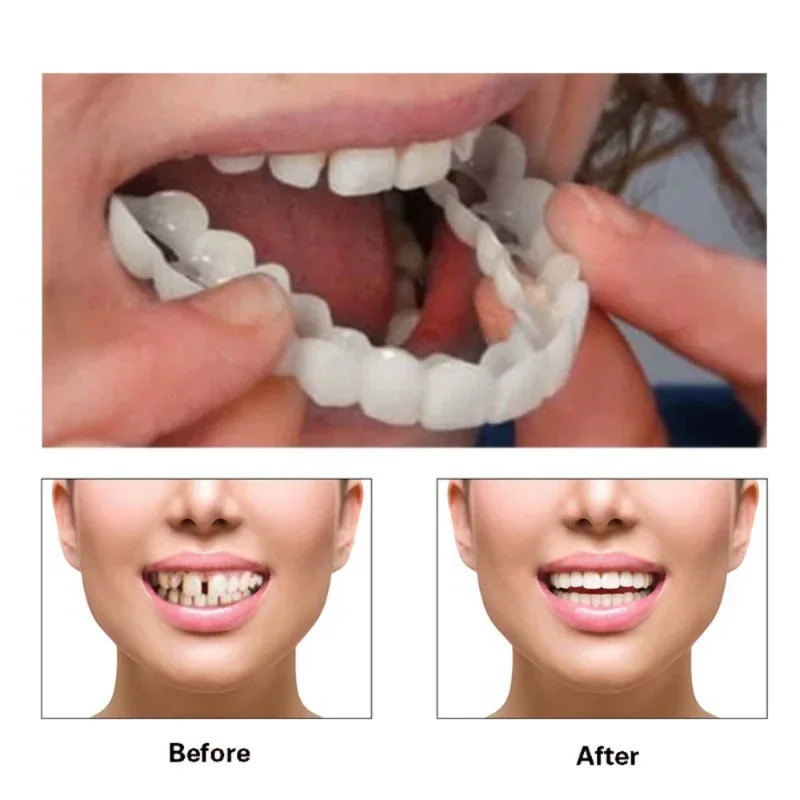 Quick Makeup Teeth Veneers, In – обзор и цена Beauty Makeup Looks