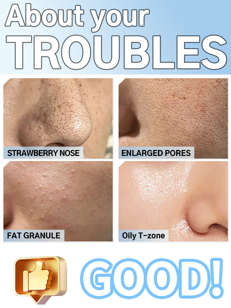 Blackhead Remover Pore Cleaner – обзор и цена Pore Vacuum