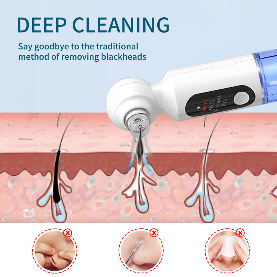 Blackhead Remover Pore Vacuum  – обзор и цена Pore Vacuum