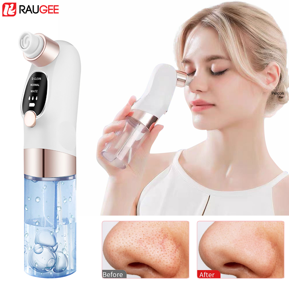 Blackhead Remover Electric Bla – обзор и цена Pore Vacuum