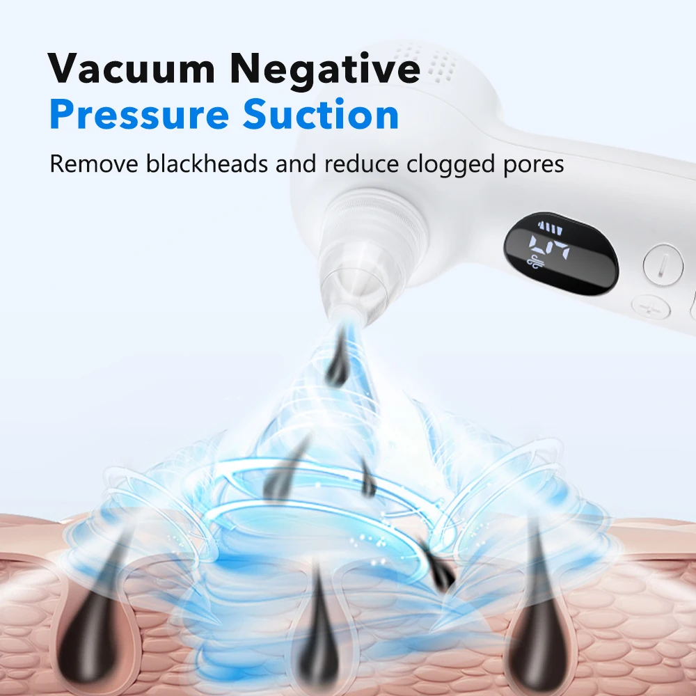 Blackhead Remover Pore Vacuum  – обзор и цена Pore Vacuum