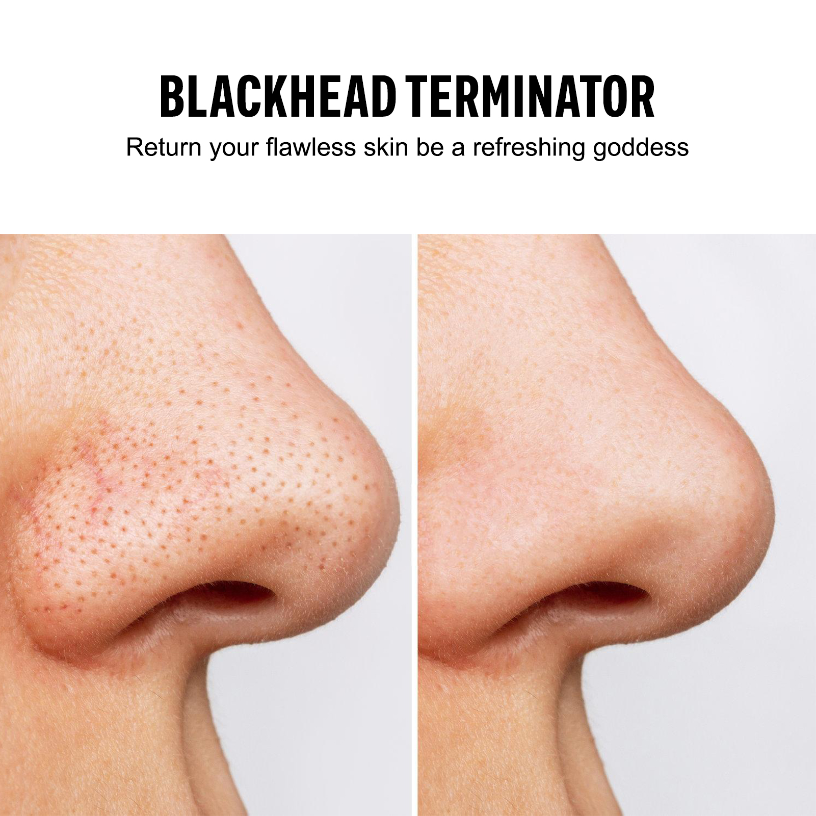 Blackhead Remover Vacuum Sucti – обзор и цена Pore Vacuum