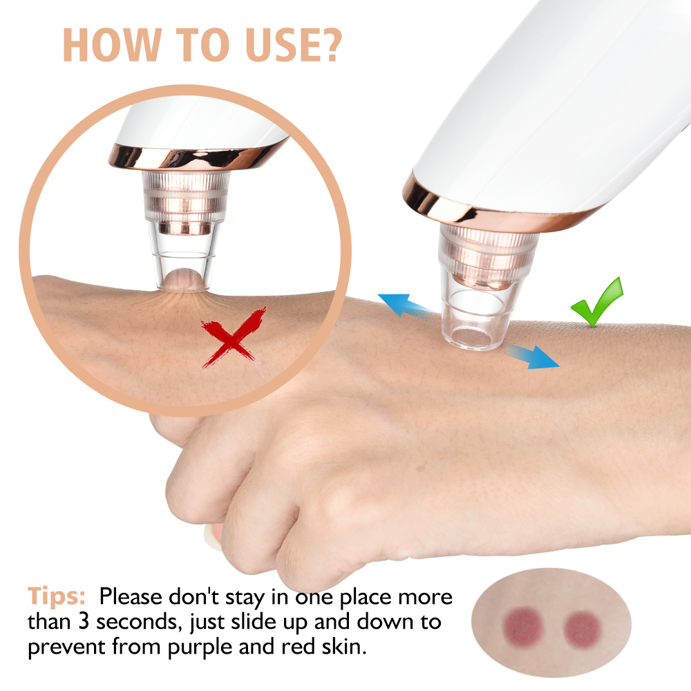 Blackhead Remover Vacuum Pore  – обзор и цена Pore Vacuum