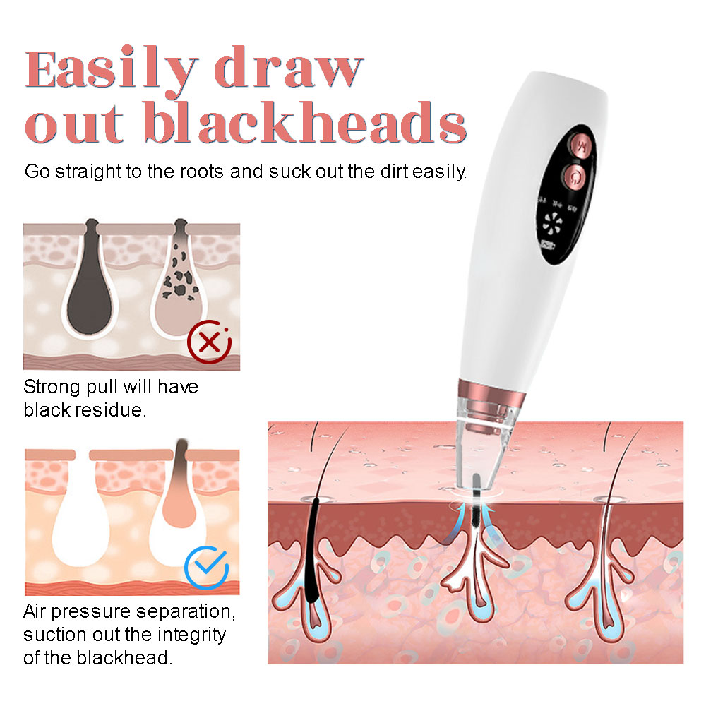 Electric Blackhead Remover Vac – обзор и цена Pore Vacuum