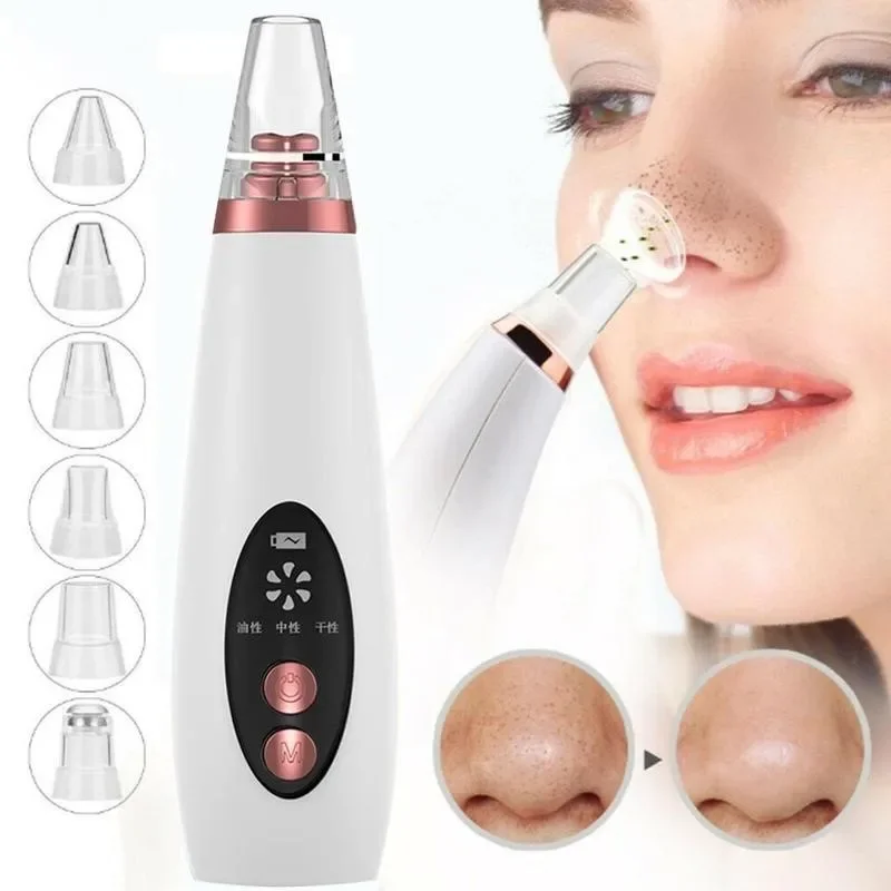 Blackhead Remover Vacuum Elect – обзор и цена Pore Vacuum